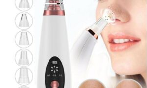 Microcrystalline Blackhead Remover Device
