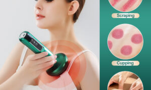 Electric Vacuum Cupping Massager with Essential Oil | Anti-Cellulite Therapy, Heating & 12-Level Suction